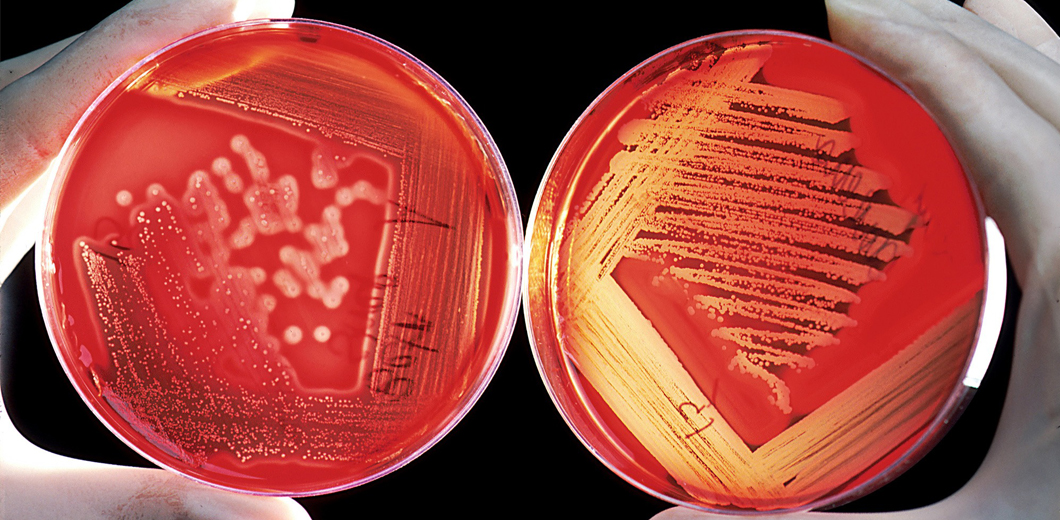 Antibacterial activity
